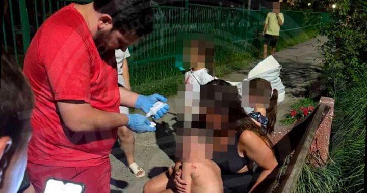 В Сочи собака напала на ребенка на детской площадке
